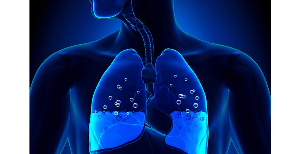 Δημιουργεί υγρό στον πνεύμονα το ηλεκτρονικό τσιγάρο;